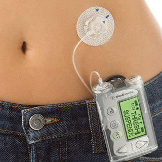 Insulin Infusion Pumps