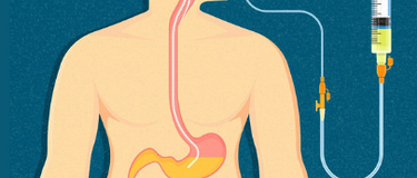 Enteral Nutrients
